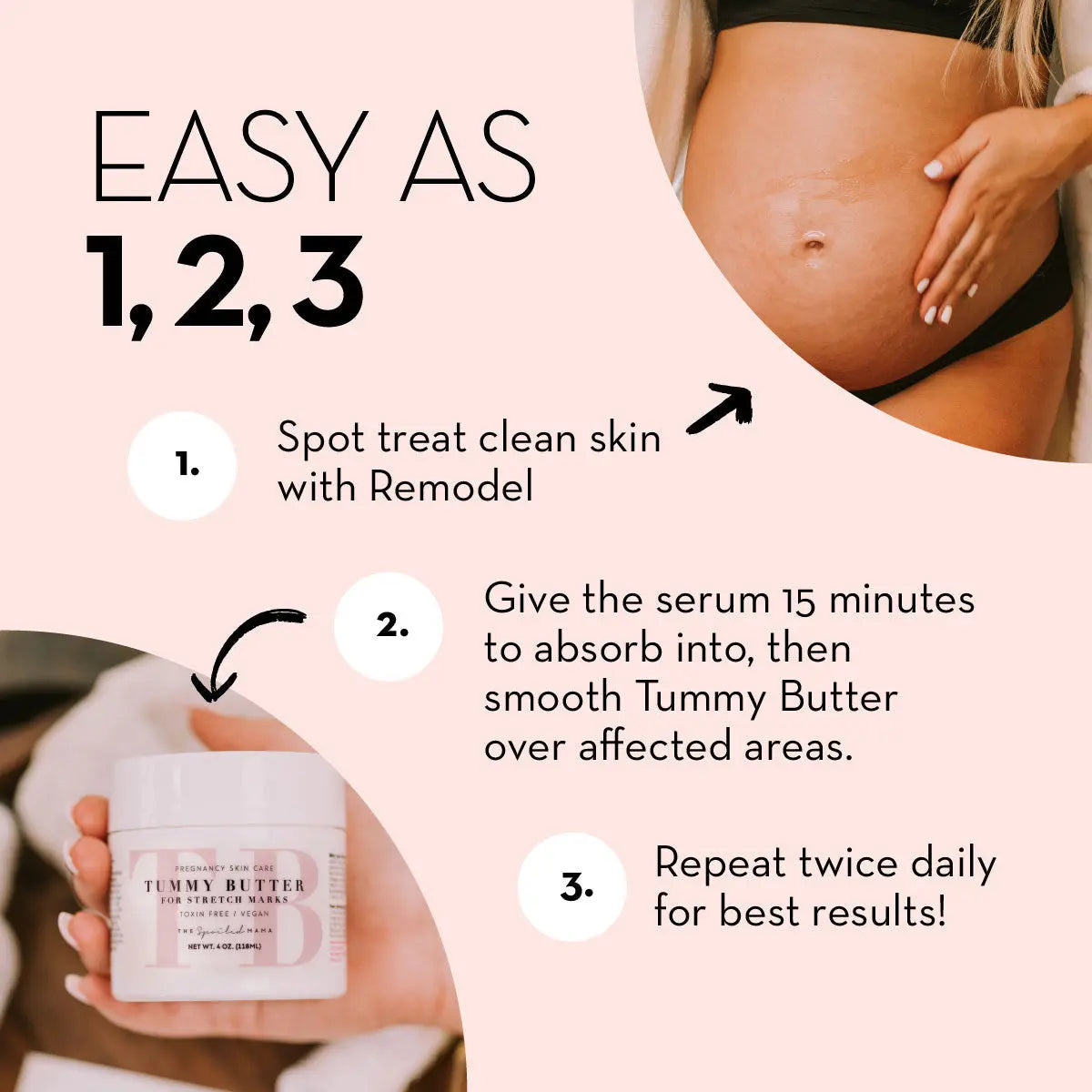 ReModel Serum: Stretch Mark Treatment The Spoiled Mama