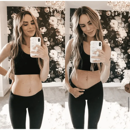 Tummy Butter Postpartum Stretch Mark Cream The Spoiled Mama